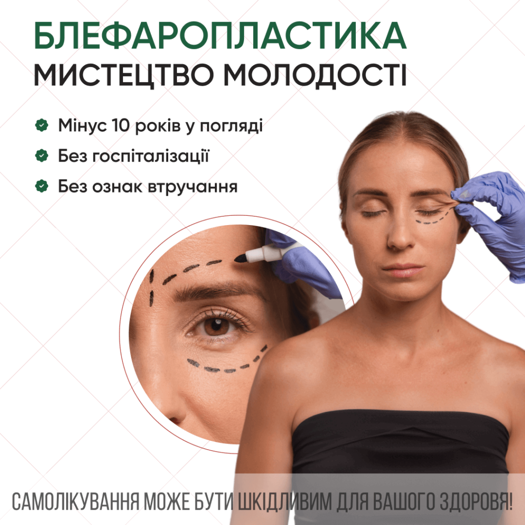 Блефаропластика Ужгород